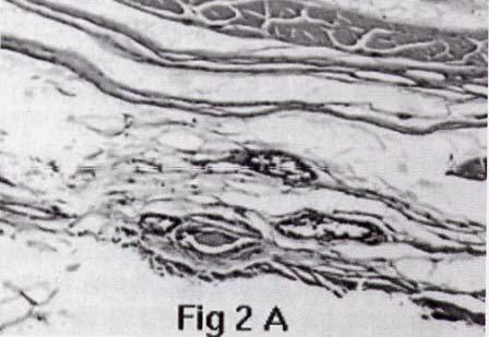 Figure 2A